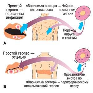 Распространение герпеса