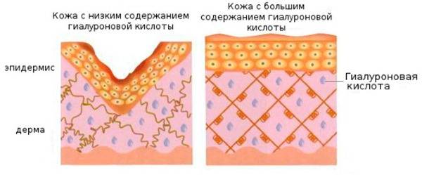 Кремы с коллагеном и гиалуроновой кислотой для лица и тела. Топ-5 лучших средств и эффективность применения, как приготовить крем самостоятельно дома. Отзывы